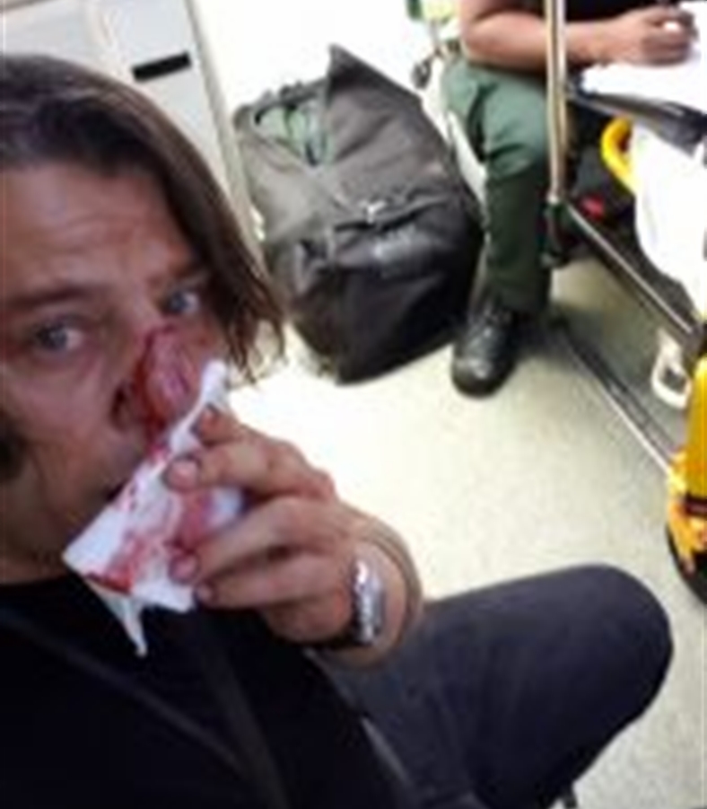 Pestato  fotoreporter napoletano mentre documenta a Londra una manifestazione. “Aggressione fascista”