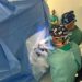 Neurochirurgia di precisione al Santobono, tumore vascolare cerebrale rimosso con il laser in risonanza magnetica. Paziente di 8 anni dimesso in 24 ore dall’intervento